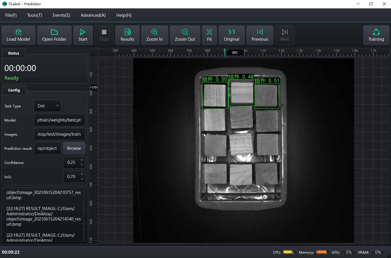 Screenshot 4 of TiVision - Simple Medical Deep Learning Training Annotation Software